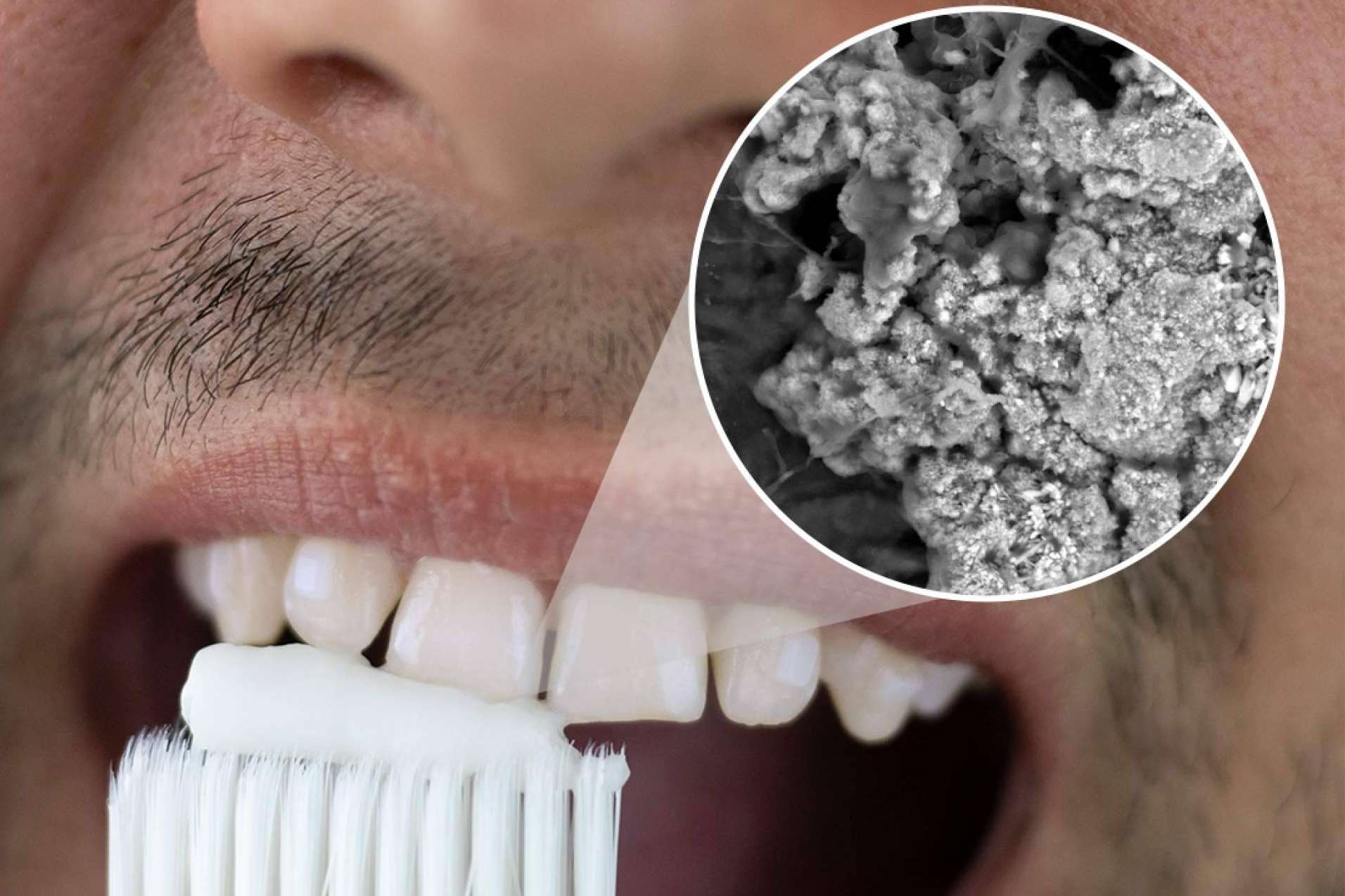 La revolución en el cuidado dental; Una pasta de dientes que regenera el esmalte y elimina manchas