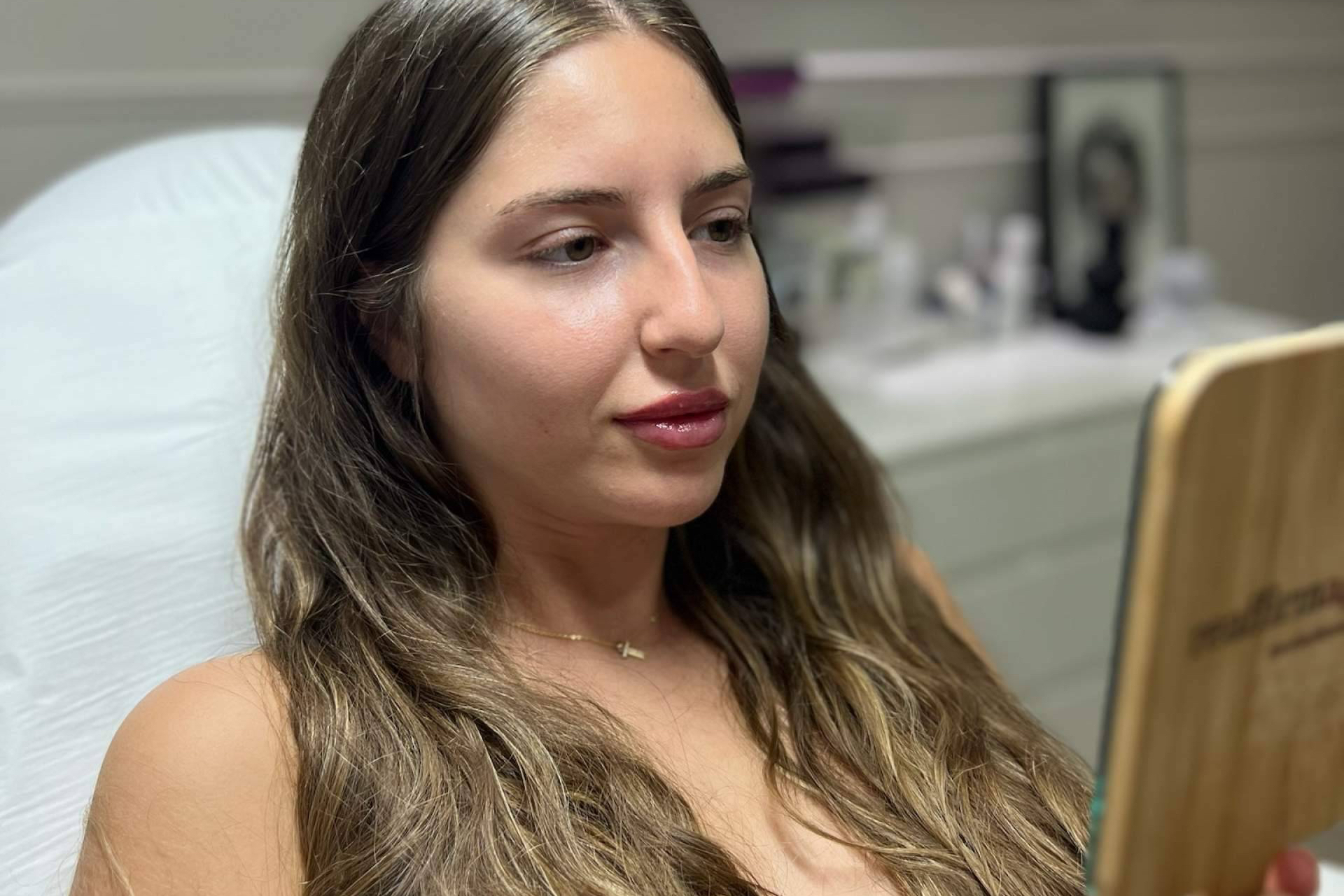Labios más bonitos y naturales; descubrir el relleno con ácido hialurónico en Málaga